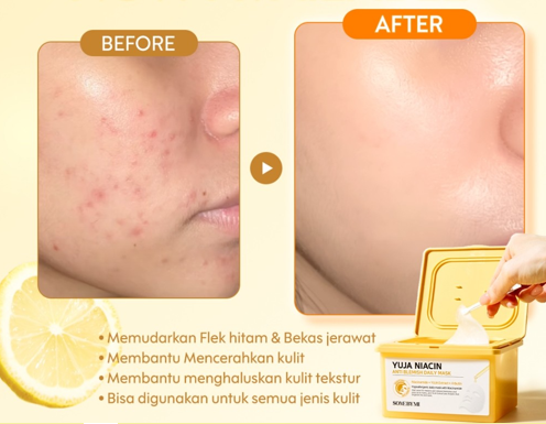 Apakah masker wajah bisa menghilangkan flek hitam?