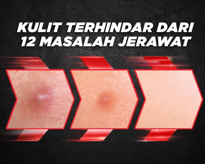 Apakah pria yang memiliki kulit berminyak dan berjerawat tetap membutuhkan pelembap?