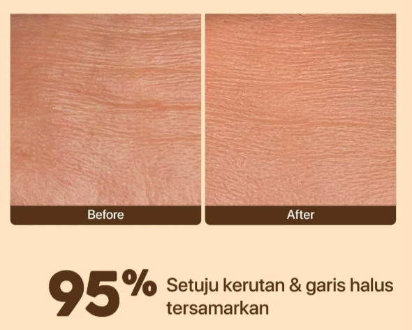 Apa kegunaan serum untuk usia 30-an?