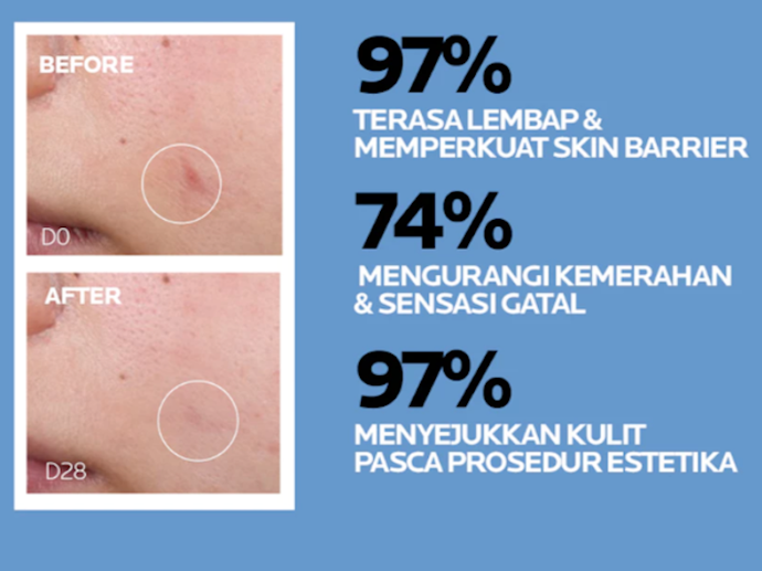 Apa ciri ciri kulit wajah kering dan bagaimana cara merawatnya?
