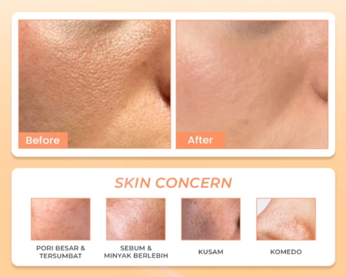 Apakah serum bisa mengecilkan pori-pori besar?