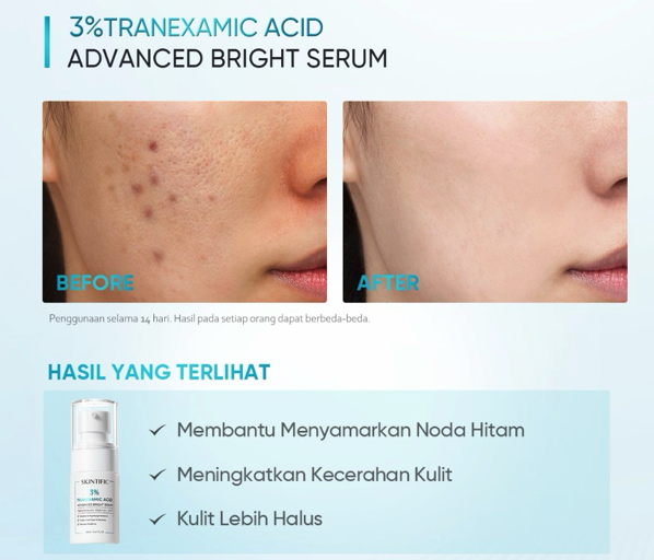 Apa manfaat serum tranexamic acid?