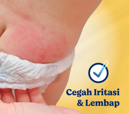 Tips bila bayi mengalami ruam setelah menggunakan popok