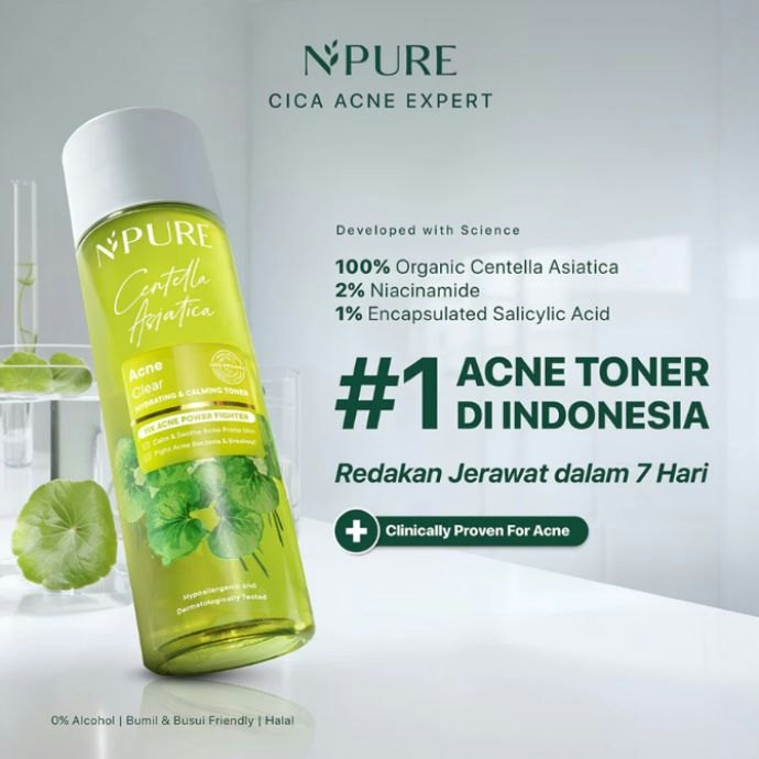 Apakah memakai toner penting untuk kulit berjerawat?
