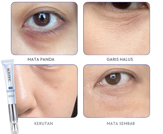 Apakah eye cream dapat menghilangkan mata panda?
