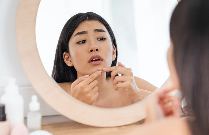 Apakah essence cocok untuk kulit berjerawat?