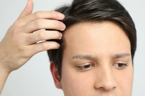Tampil maskulin dengan rambut palsu, siapa takut?