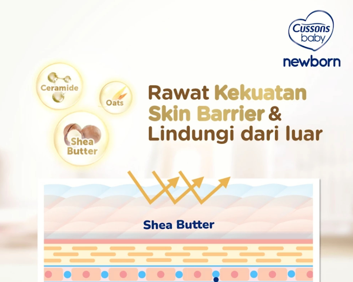 Apa penyebab milia pada bayi?