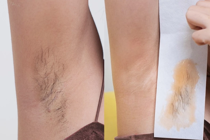 Apakah sugar wax membuat ketiak menjadi hitam?