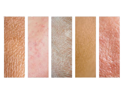 Apa ciri-ciri dan penyebab kulit badan sensitif?