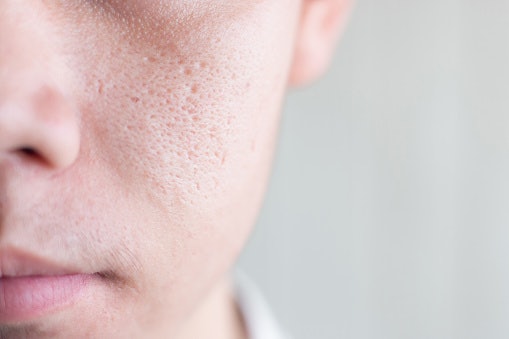 Apakah clay mask bisa mengecilkan pori-pori?