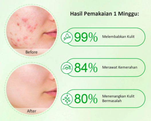 Apakah kulit bruntusan boleh memakai pelembap?