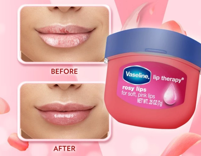 Apakah lip balm bisa mengatasi bibir kering?