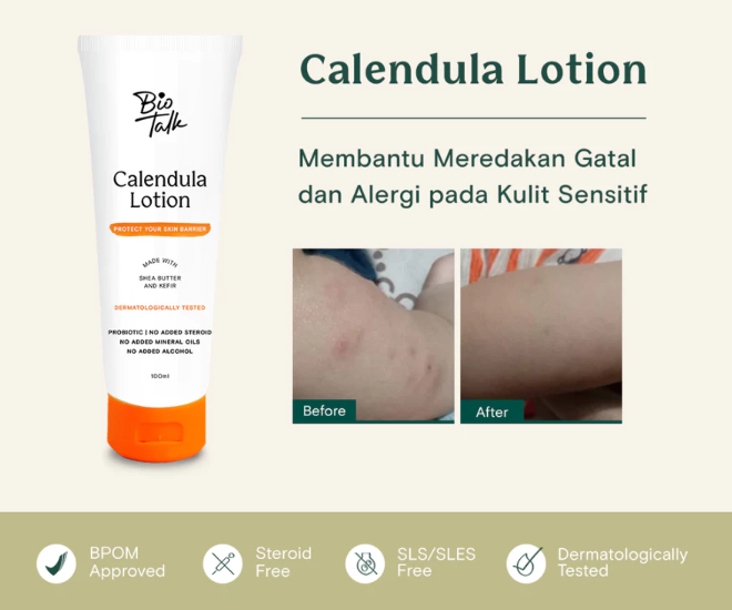 Calendula cream digunakan untuk apa?