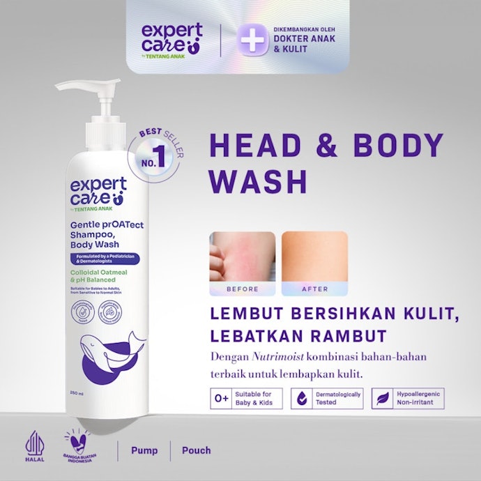 Apa perbedaan gatal akibat biang keringat dan alergi?