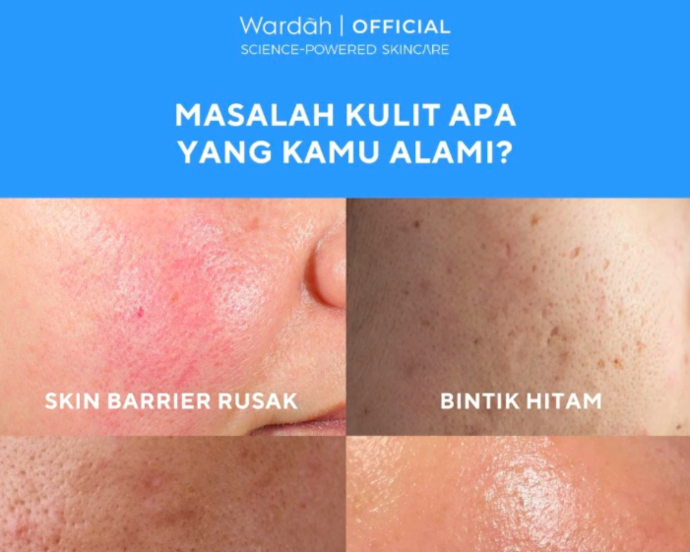 Apakah produk sunscreen cocok untuk semua jenis kulit?