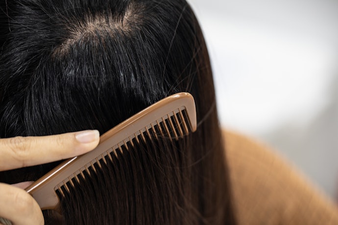 Apa penyebab rambut berminyak?