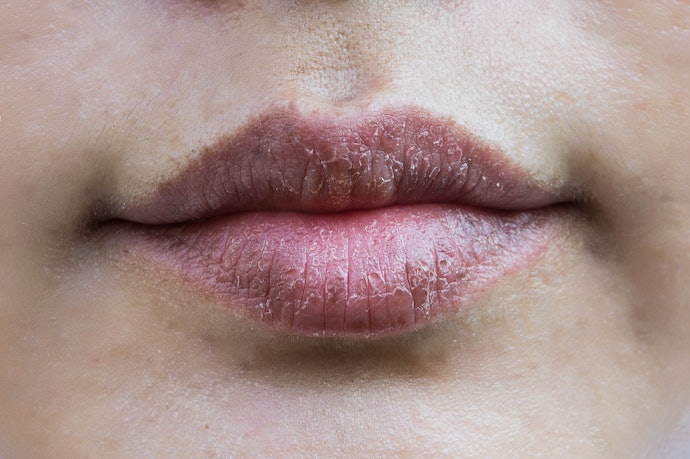 Apakah pemilik bibir kering boleh menggunakan lipstik?
