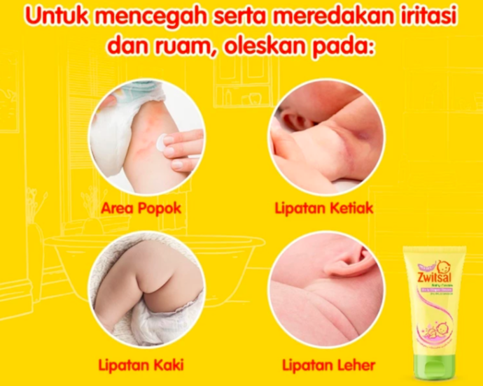 Apakah bayi boleh memakai salep gatal?