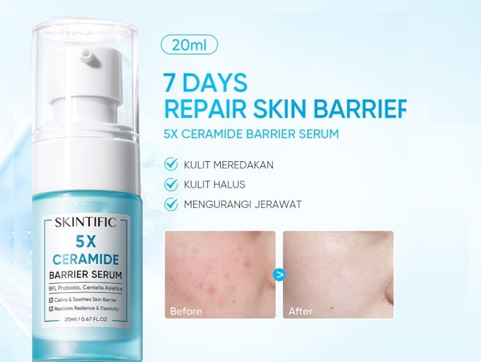 Apakah serum bisa membantu memperbaiki skin barrier?