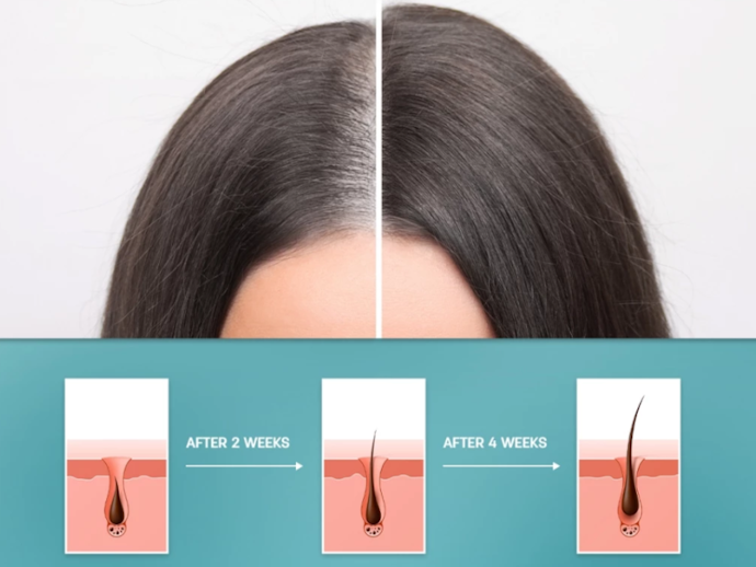Apakah hair tonic bisa mengatasi rambut rontok?