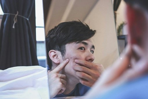 Apakah serum dapat membantu mengatasi kulit pria yang berjerawat?