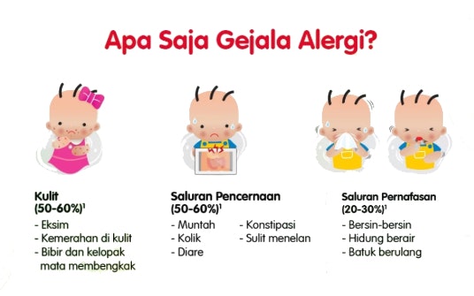 Apakah susu soya baik untuk bayi?