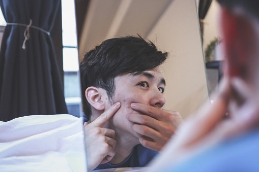 Apakah serum dapat membantu mengatasi kulit pria yang berjerawat?