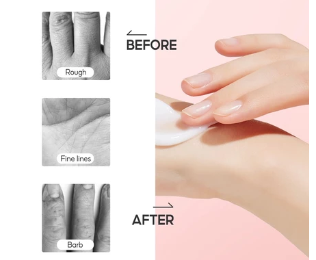 Apakah hand cream efektif dalam mengatasi kulit kasar karena kering?
