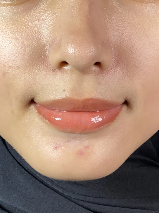 Suntone Wisdom Indonesia Glad2Glow Brightening Lip Serum Translation missing: id.activerecord.decorators.item_part_image/alt
