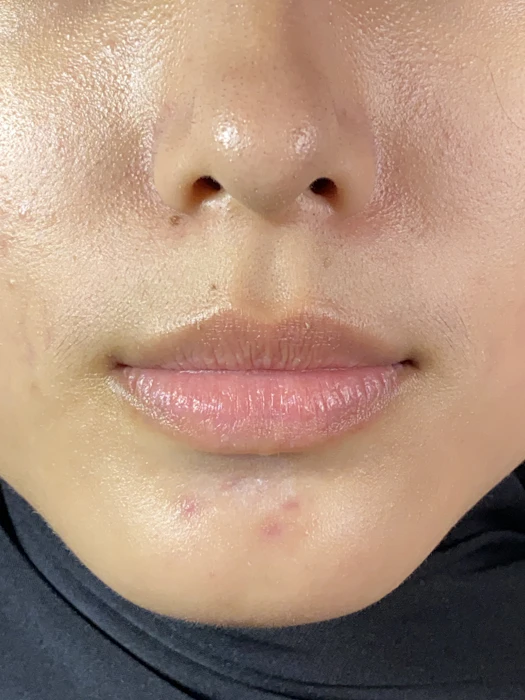 Suntone Wisdom Indonesia Glad2Glow Brightening Lip Serum Translation missing: id.activerecord.decorators.item_part_image/alt