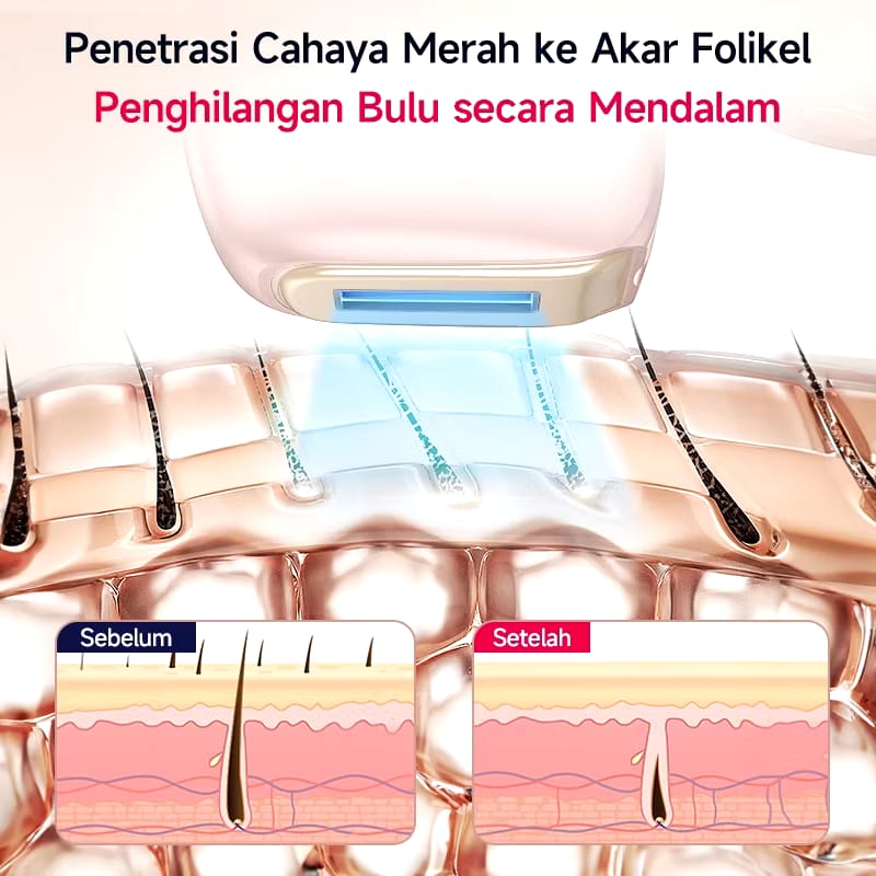  AmazeFan Hair Removal Laser Air-pink Cool 10°