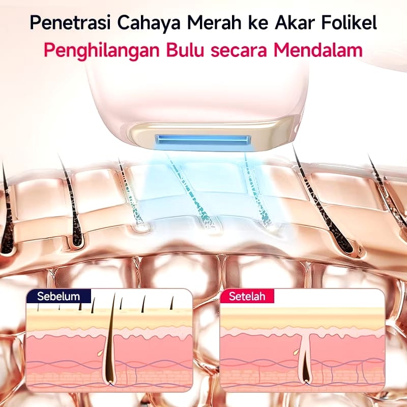 AmazeFan Hair Removal Laser Air-pink Cool 10° 4