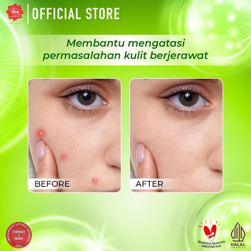Acne Serum 5