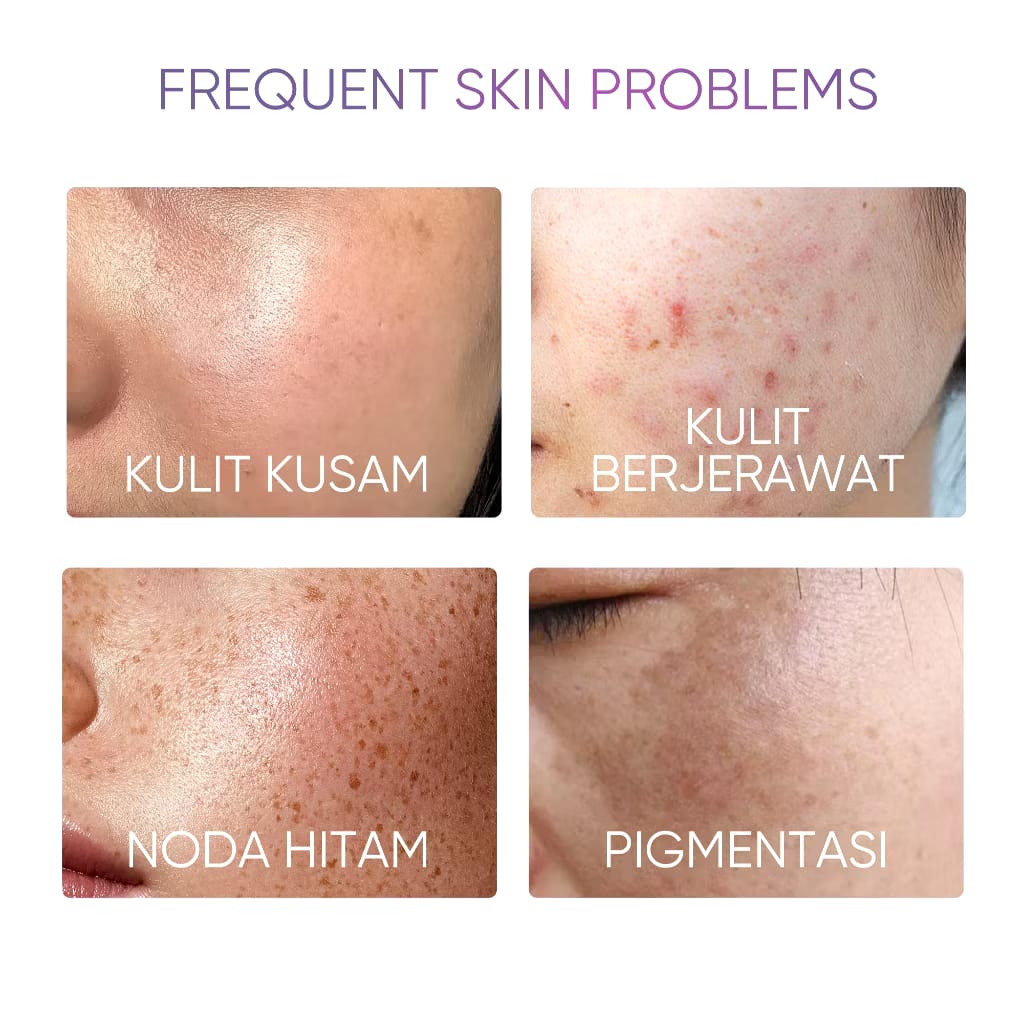 SKINTIFIC Cosmetics SKINTIFIC SymWhite 377 Dark Spot Serum