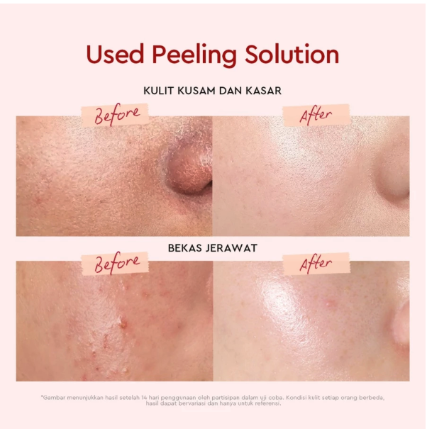 Suntone Wisdom Indonesia Glad2Glow AHA BHA PHA Intensive Peeling Solution