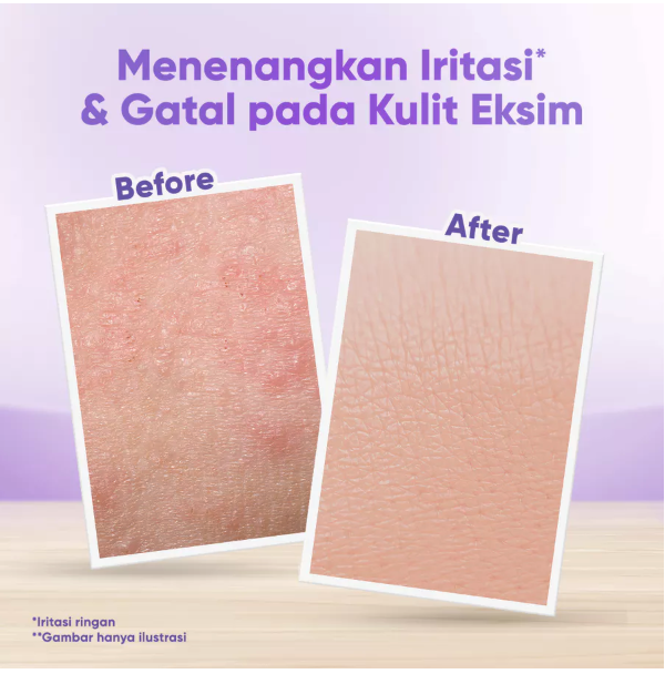 PZ. Cussons Indonesia Cussons Baby Sensicare Intensive Soothing Cream