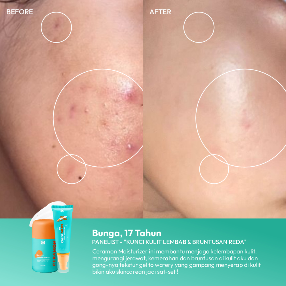 Pesona Dalam Negri Prettywell CeraMON Barrier Moistfull Gel