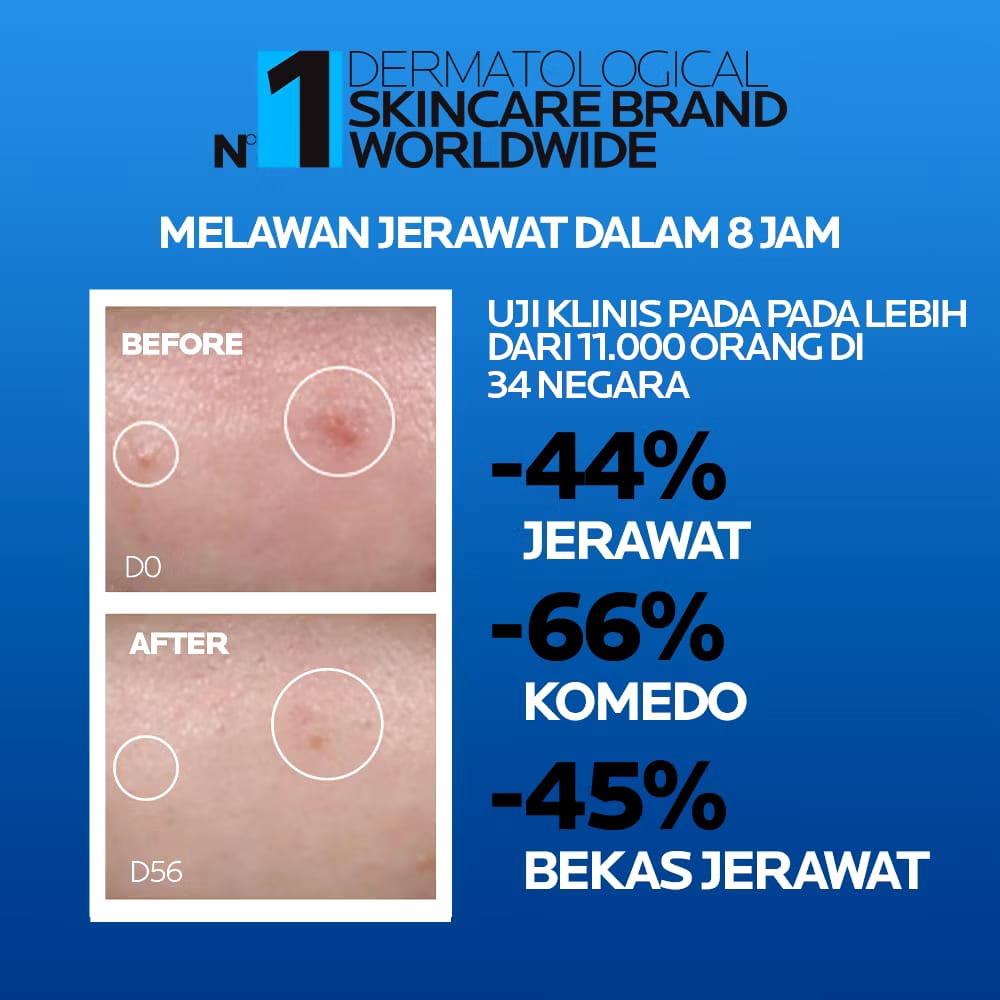 L’Oréal La Roche-Posay Effaclar Duo+M