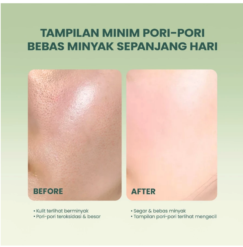 AcnePlus AHA BHA PHA Daily Essence Toner 4