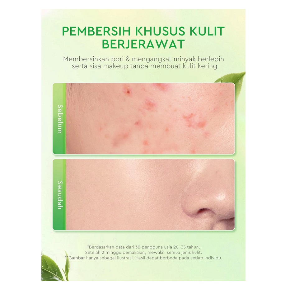 Suntone Wisdom Indonesia Glad2Glow Matcha Salicylic Acid Acne Cleanser