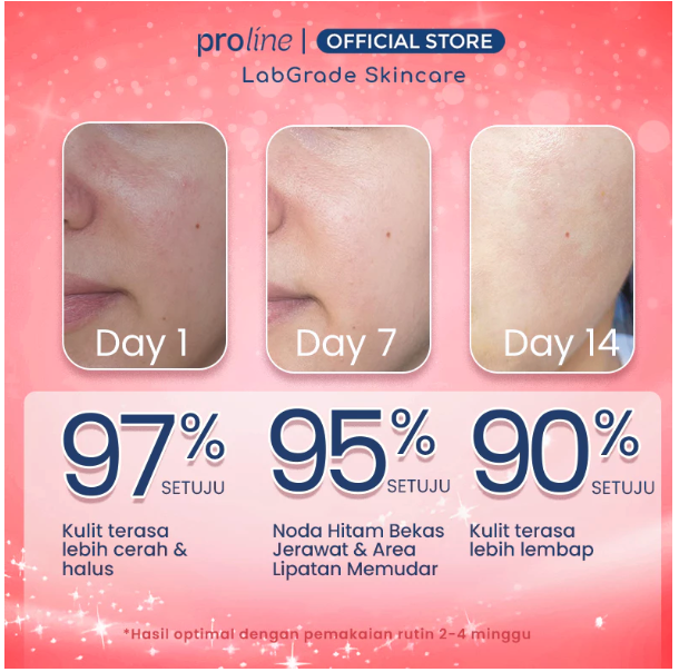 Proline Innovation Indonesia  Proline Glyco Moist 10% Glycolic Acid