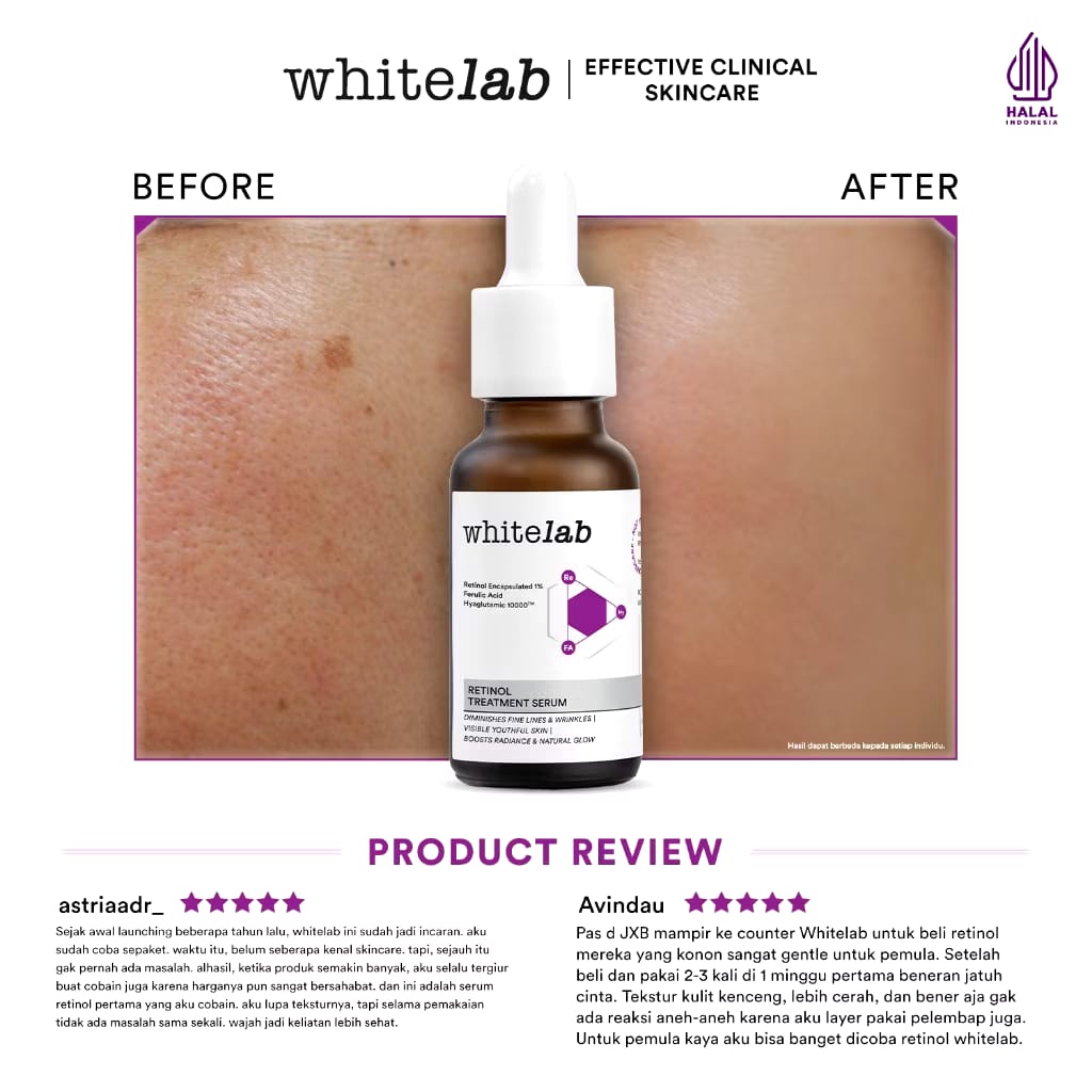 Natura Deca Kosmetika Whitelab Retinol Treatment Serum