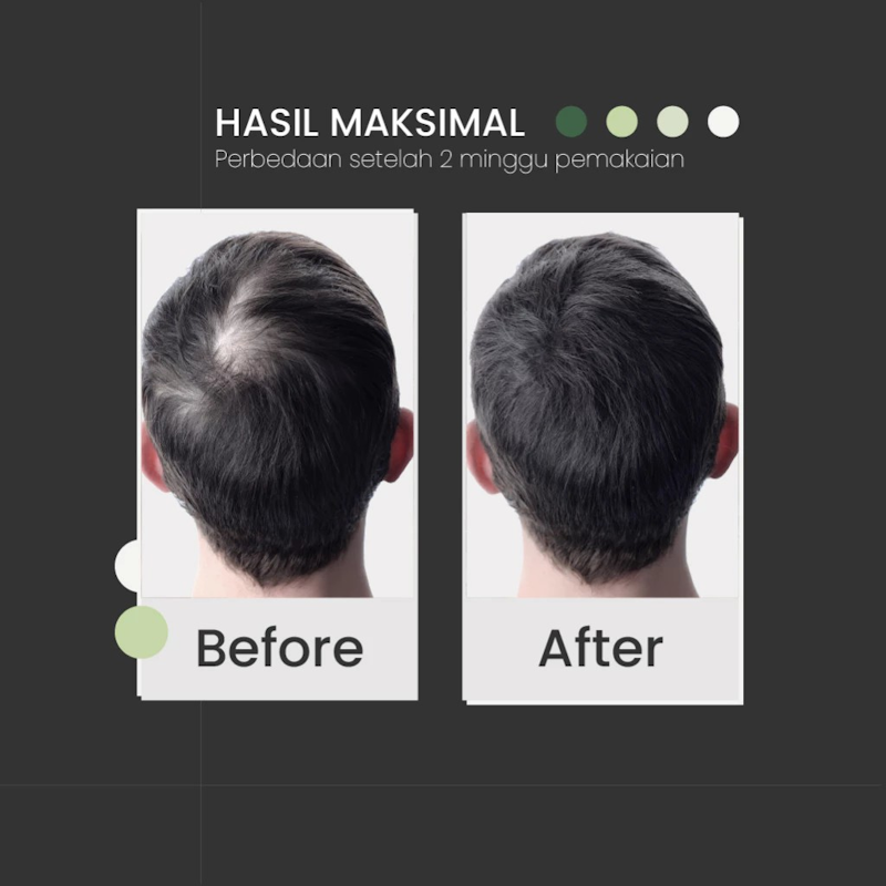 SHUMI Japan Hair Tonic 5