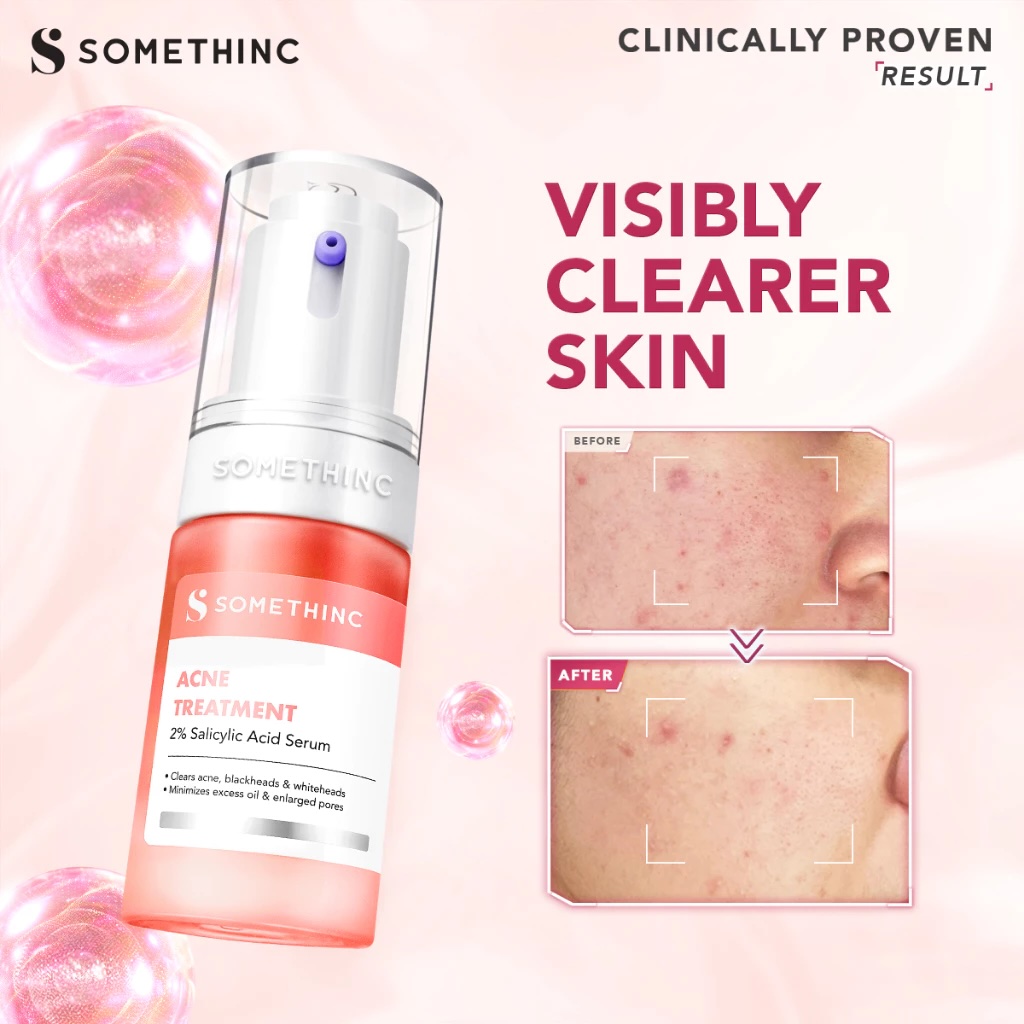 Royal Pesona Indonesia SOMETHINC Acne Treatment 2% Salicylic Acid Serum