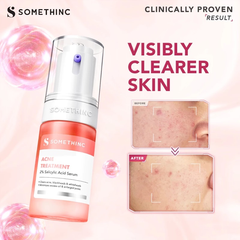 Acne Treatment 2% Salicylic Acid Serum 5