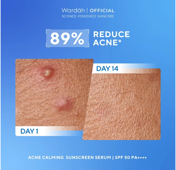 Paragon Technology and Innovation Wardah UV Shield Acne Calming Sunscreen Serum SPF 50 PA++++