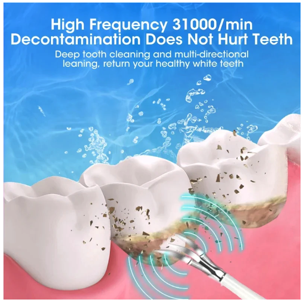  Dr. Spock Smart Ultrasonic Teeth Cleaner ET01