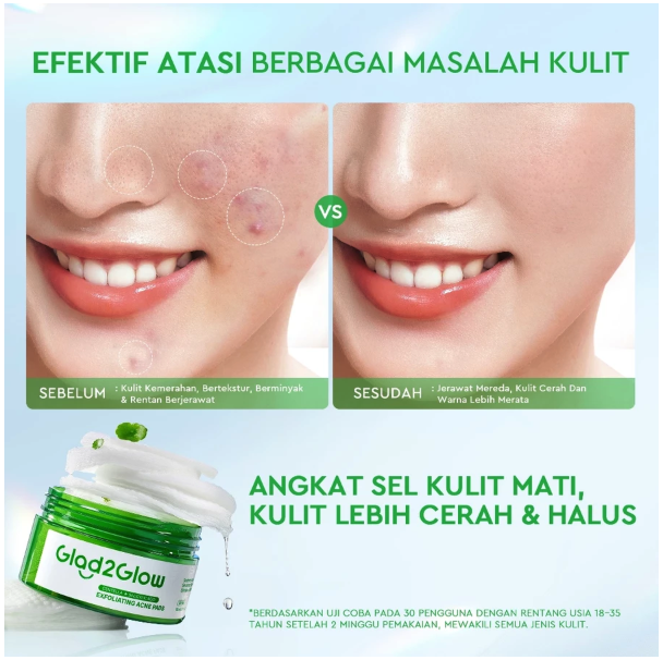  Suntone Wisdom Indonesia Glad2Glow Centella + Salicylic Acid Exfoliating Acne Pads