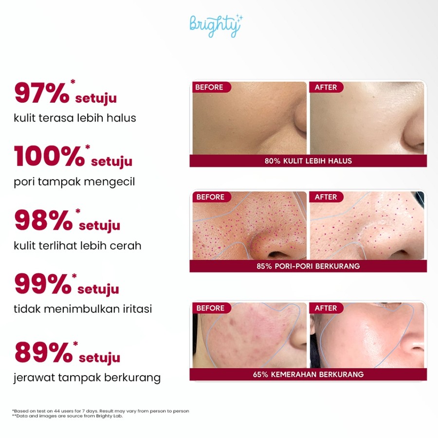 Brighty Global Sinergi​​  Brighty 20% AHA BHA PHA LHA Peeling Solution